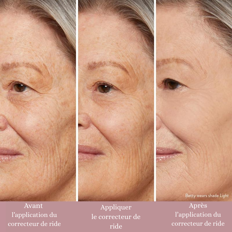 Combleur de rides instantané