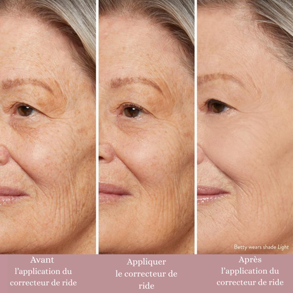 Combleur de rides instantané